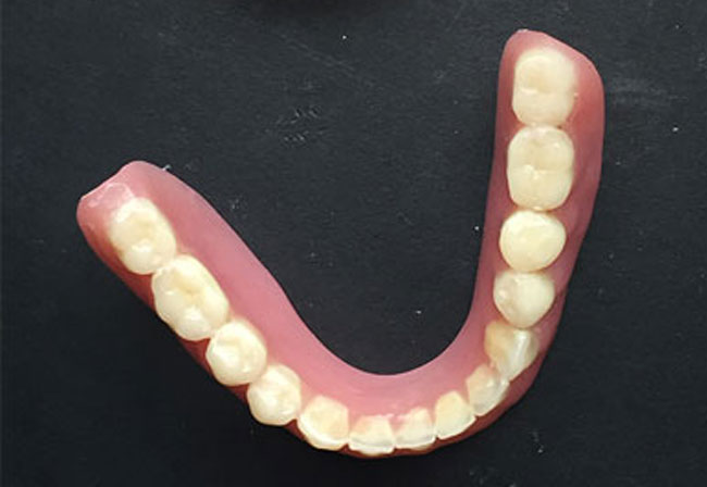 proteza akrylowa dolna częściowa i całkowita 